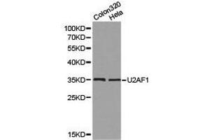 Western Blotting (WB) image for anti-U2 Small Nuclear RNA Auxiliary Factor 1 (U2AF1) antibody (ABIN1875401) (U2AF1 抗体)