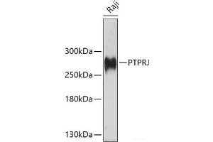 Western blot analysis of extracts of Raji cells using PTPRJ Polyclonal Antibody at dilution of 1:1000. (PTPRJ 抗体)