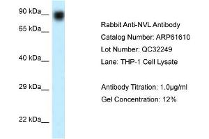 Western Blotting (WB) image for anti-Nuclear VCP-Like (NVL) (N-Term) antibody (ABIN2788850) (NVL 抗体  (N-Term))