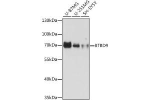 Western blot analysis of extracts of various cell lines, using BTBD9 Rabbit pAb (ABIN7265955) at 1:1000 dilution. (BTBD9 抗体)