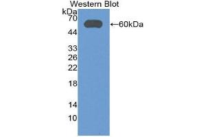 Western Blotting (WB) image for anti-Aldehyde Dehydrogenase 7 Family, Member A1 (ALDH7A1) (AA 1-539) antibody (ABIN3201764)