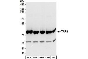 anti-threonyl-tRNA Synthetase (TARS) (AA 673-723) antibody