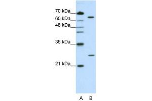 WB Suggested Anti-NUDT21 Antibody Titration:  1. (NUDT21 抗体  (N-Term))