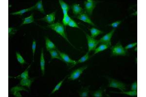 Immunofluorescence staining of NIH/3T3 cells with ABIN7157624 at 1:133, counter-stained with DAPI. (KIF22 抗体  (AA 34-169))