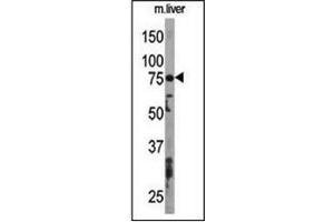 Western blot analysis using ATG7 Antibody  to detect APG7L in Mouse liver tissue lysate. (ATG7 抗体  (AA 501-531))