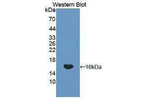 Western blot analysis of the recombinant protein. (GP1BB 抗体  (AA 52-164))