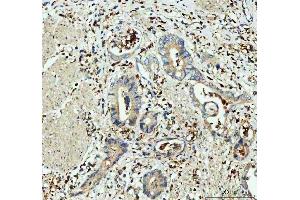 IHC analysis of GPX1 using anti-GPX1 antibody (ABIN3043834). (Glutathione Peroxidase 1 抗体  (Middle Region))