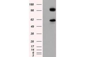 Image no. 5 for anti-Transforming, Acidic Coiled-Coil Containing Protein 3 (TACC3) antibody (ABIN1498097) (TACC3 抗体)