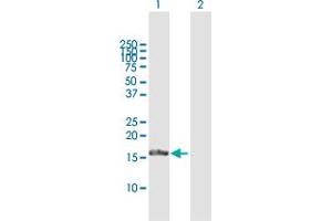 Western Blot analysis of FGF1 expression in transfected 293T cell line by FGF1 MaxPab polyclonal antibody. (FGF1 抗体  (AA 1-155))