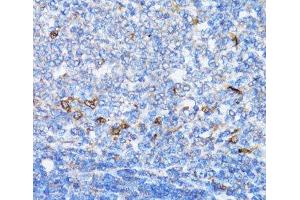 Immunohistochemistry of paraffin-embedded Rat spleen using NDE1 Polyclonal Antibody at dilution of 1:100 (40x lens). (NDE1 抗体)