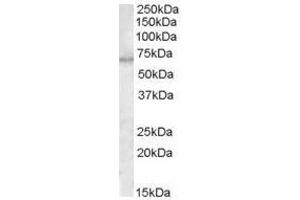 Image no. 1 for anti-Myotubularin 1 (MTM1) (C-Term) antibody (ABIN374119) (MTM1 抗体  (C-Term))