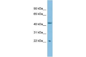 WB Suggested Anti-POLR1E Antibody Titration: 0. (POLR1E 抗体  (N-Term))