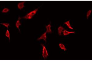 ABIN6272414 staining Hela by IF/ICC. (RHOG 抗体  (Internal Region))