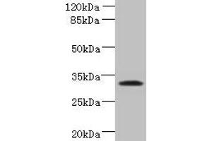 Western blot All lanes: TSPAN5 antibody at 1. (Tetraspanin 5 抗体  (AA 114-232))