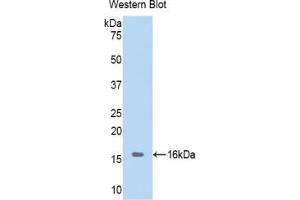 Detection of Recombinant Hemoglobin, Porcine using Polyclonal Antibody to Hemoglobin (HB)