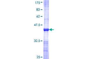 GUCY1A2 Protein (AA 296-401) (GST tag)