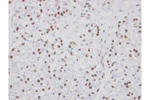 IHC-P Image Immunohistochemical analysis of paraffin-embedded human oral tissue, using PUF60, antibody at 1:100 dilution. (PUF60 抗体  (C-Term))