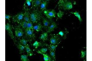 Immunofluorescence (IF) image for anti-NQO2 (NQO2) antibody (ABIN1499816) (NQO2 抗体)