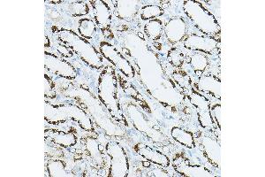 Immunohistochemistry of paraffin-embedded rat kidney using CDC42 Rabbit pAb (ABIN3021670, ABIN3021671, ABIN3021672 and ABIN6215499) at dilution of 1:50 (40x lens).