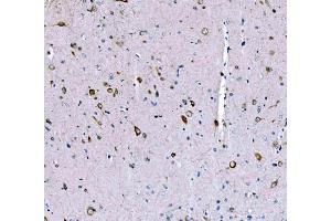 IHC analysis of SCRN1 using anti-SCRN1 antibody (ABIN7602923). (Secernin 1 抗体  (C-Term))