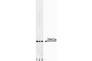 Western blot analysis of Bcl-2. (Bcl-2 抗体)