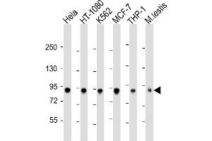 All lanes : Anti-TBK1 Antibody  at 1:2000 dilution Lane 1: Hela whole cell lysate Lane 2: HT-1080 whole cell lysate Lane 3: K562 whole cell lysate Lane 4: MCF-7 whole cell lysate Lane 5: THP-1 whole cell lysate Lane 6: mouse testis lysate Lysates/proteins at 20 μg per lane. (TBK1 抗体  (AA 150-181))
