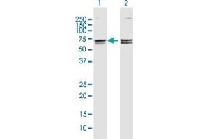 Western Blot analysis of CACNB3 expression in transfected 293T cell line by CACNB3 MaxPab polyclonal antibody. (CACNB3 抗体  (AA 1-484))