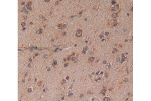 Immunohistochemistry (IHC) image for anti-14-3-3 theta (YWHAQ) (AA 1-241) antibody (ABIN5013031)
