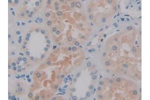 Immunohistochemistry (IHC) image for anti-Interleukin 2 (IL2) (AA 21-153) antibody (ABIN7428635)