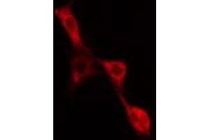 ABIN6277567 staining NIH-3T3 cells by IF/ICC. (EIF4B 抗体  (Internal Region))
