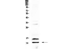 Western blot analysis of PF4 using anti-PF4 antibody . (PF4 抗体  (AA 30-105))