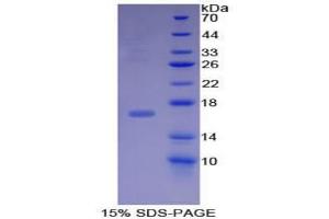 SDS-PAGE analysis of Mouse BMP15 Protein. (BMP15 蛋白)