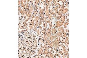 Immunohistochemical analysis of paraffin-embedded human kidney tissue using (ABIN657731 and ABIN2846716) performed on the Leica® BOND RXm.