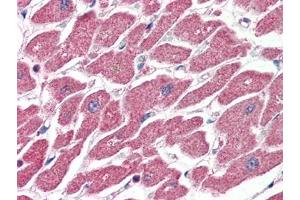 Human Heart (formalin-fixed, paraffin-embedded) stained with CPT1Aat 4 µg/ml followed by biotinylated anti-goat IgG secondary antibody, alkaline phosphatase-streptavidin and chromogen. (CPT1A 抗体  (Internal Region))