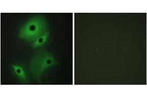 Immunofluorescence (IF) image for anti-Neuroblastoma 1, DAN Family BMP Antagonist (NBL1) (AA 131-180) antibody (ABIN2889475) (NBL1 抗体  (AA 131-180))