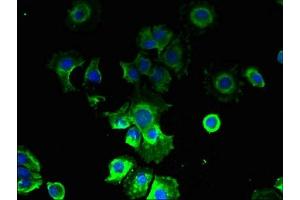 Immunofluorescent analysis of MCF-7 cells using ABIN7146656 at dilution of 1:100 and Alexa Fluor 488-congugated AffiniPure Goat Anti-Rabbit IgG(H+L) (CMTR2 抗体  (AA 301-600))