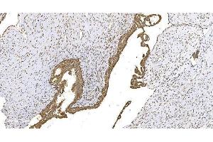 IHC analysis of WEE1 using anti-WEE1 antibody (ABIN6719614). (WEE1 抗体)