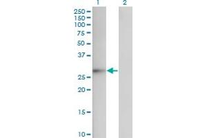 Western Blotting (WB) image for anti-Fibroblast Growth Factor 12 (FGF12) (AA 1-182) antibody (ABIN598680) (FGF12 抗体  (AA 1-182))