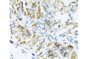 Immunohistochemistry of paraffin-embedded Mouse lung using VAMP1 Polyclonal Antibody at dilution of 1:100 (40x lens). (VAMP1 抗体)