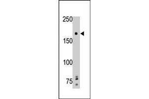 The PTPRG polyclonal antibody  is used in Western blot to detect PTPRG in mouse brain tissue lysate. (PTPRG 抗体  (Internal Region))