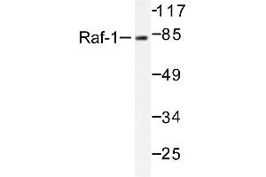 Image no. 1 for anti-V-Raf-1 Murine Leukemia Viral Oncogene Homolog 1 (RAF1) antibody (ABIN271798) (RAF1 抗体)