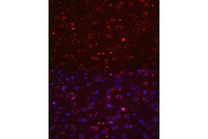 Immunofluorescence (IF) image for anti-Signal Transducer and Activator of Transcription 3 (Acute-Phase Response Factor) (STAT3) (AA 640-770) antibody (ABIN6148568)