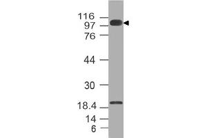 Image no. 1 for anti-Furin (Paired Basic Amino Acid Cleaving Enzyme) (FURIN) (AA 602-791) antibody (ABIN5027210) (FURIN 抗体  (AA 602-791))