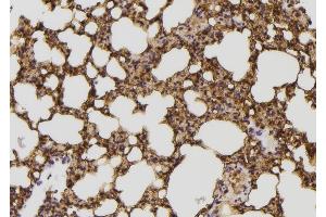 ABIN6257902 and ABIN6274337 at 1/100 staining Mouse lung tissue by IHC-P. (IB2 抗体  (Internal Region))