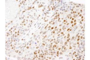 Immunohistochemistry (IHC) image for anti-Replication Protein A2, 32kDa (RPA2) (C-Term) antibody (ABIN7449012)