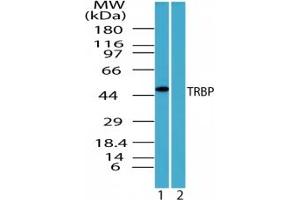 Image no. 3 for anti-TAR (HIV-1) RNA Binding Protein 2 (TARBP2) (AA 340-390) antibody (ABIN207742) (TARBP2 抗体  (AA 340-390))
