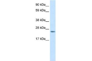 WB Suggested Anti-FADD Antibody Titration:  0. (FADD 抗体  (C-Term))