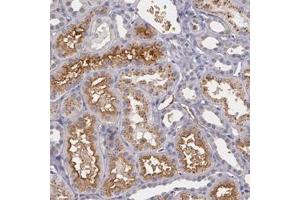 Immunohistochemical staining of human kidney with PTS polyclonal antibody  shows cytoplasmic and membranous positivity in cells of renal tubules at 1:50-1:200 dilution. (PTS 抗体)