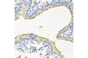 Immunohistochemistry of paraffin-embedded mouse lung using STRN3 antibody at dilution of 1:100 (x40 lens). (STRN3 抗体)