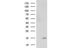 Western Blotting (WB) image for anti-NADH Dehydrogenase (Ubiquinone) 1 alpha Subcomplex, 7, 14.5kDa (NDUFA7) antibody (ABIN1499657) (NDUFA7 抗体)